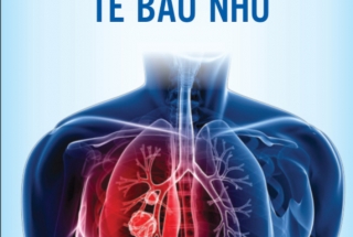 UNG THƯ PHỔI TẾ BÀO NHỎ